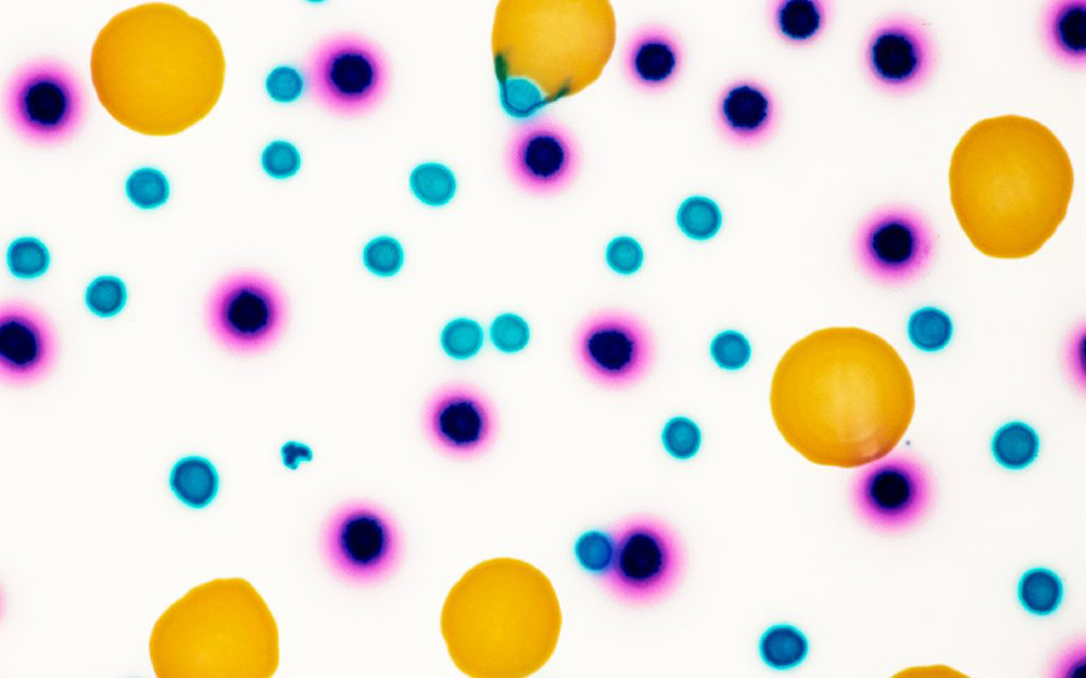 image-Unraveling How Gut Bacteria Affect Our Health