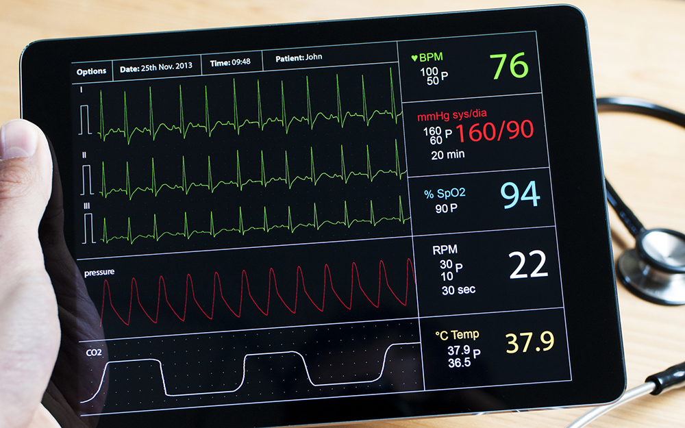 Electrocardiogram (EKG) test