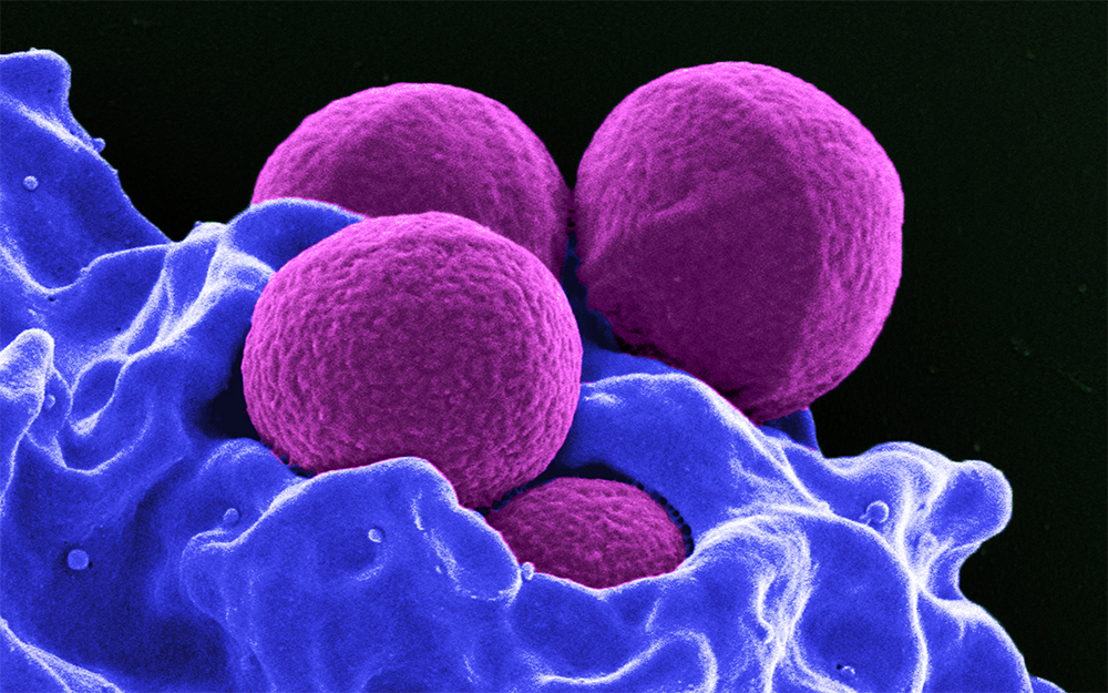 Staphylococcus aureus, MRSA, bacteria, infection