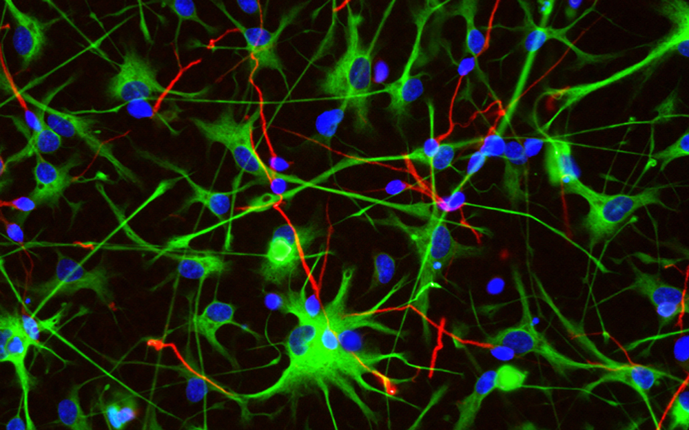 neural progenitor cells through a fluorescence microscope 
