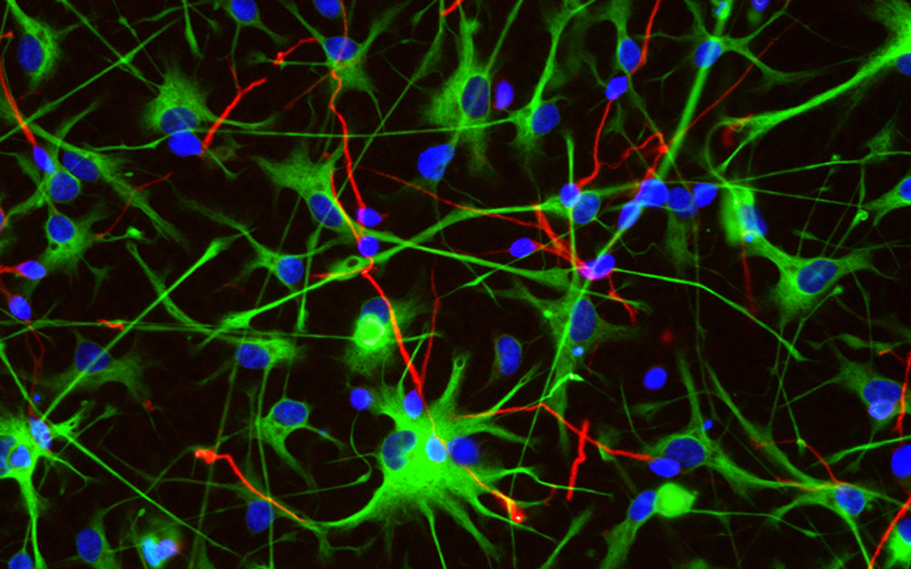 neural progenitor cells through a fluorescence microscope