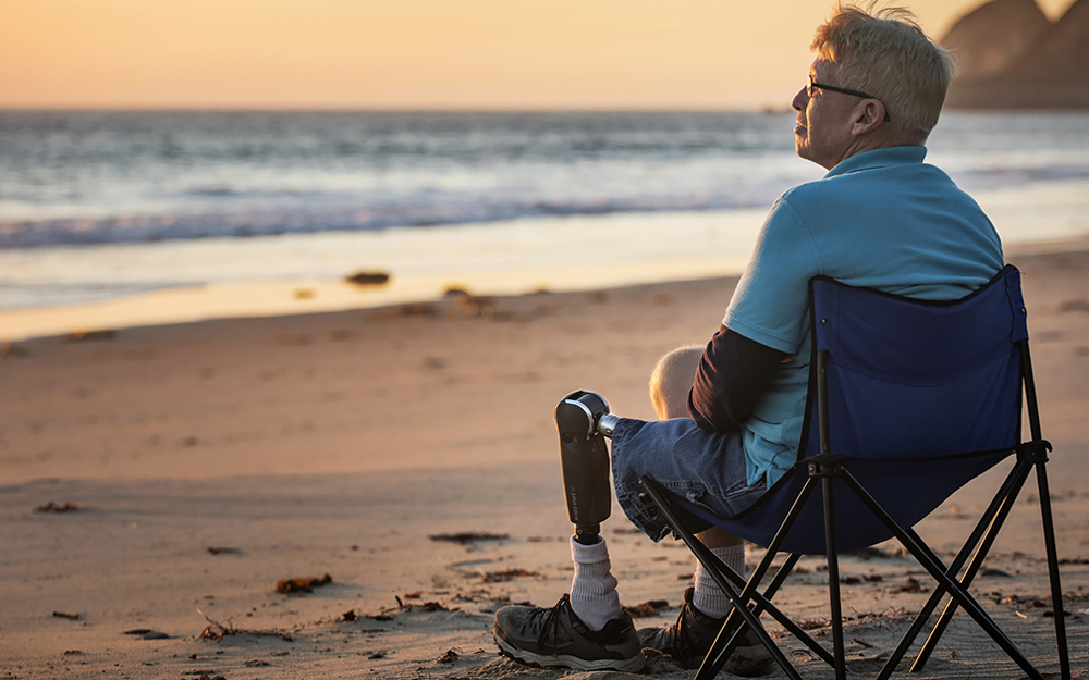 Cedars-Sinai patient walking again after prosthetic leg