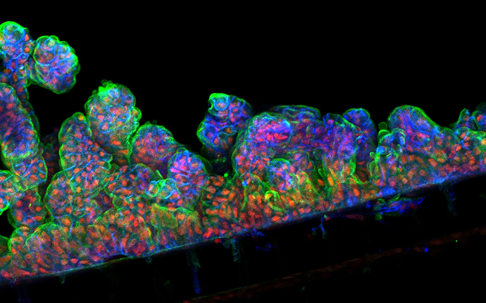 New Organ-Chip Can Re-Create Intestinal Cells teaser image
