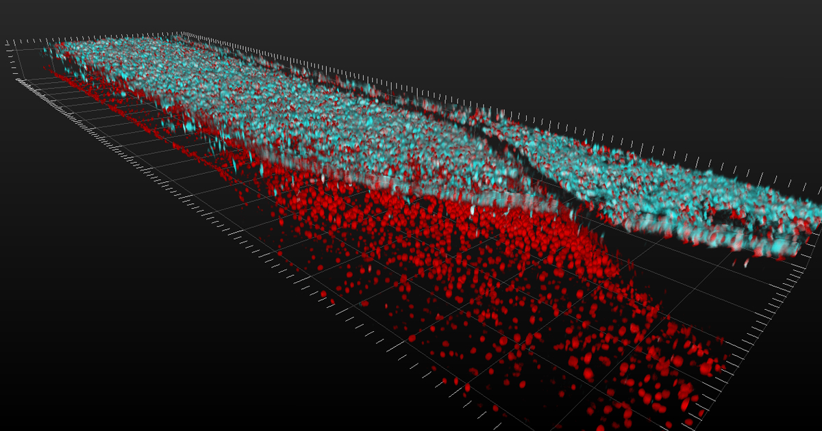 Layers of spinal motor neuron cells.