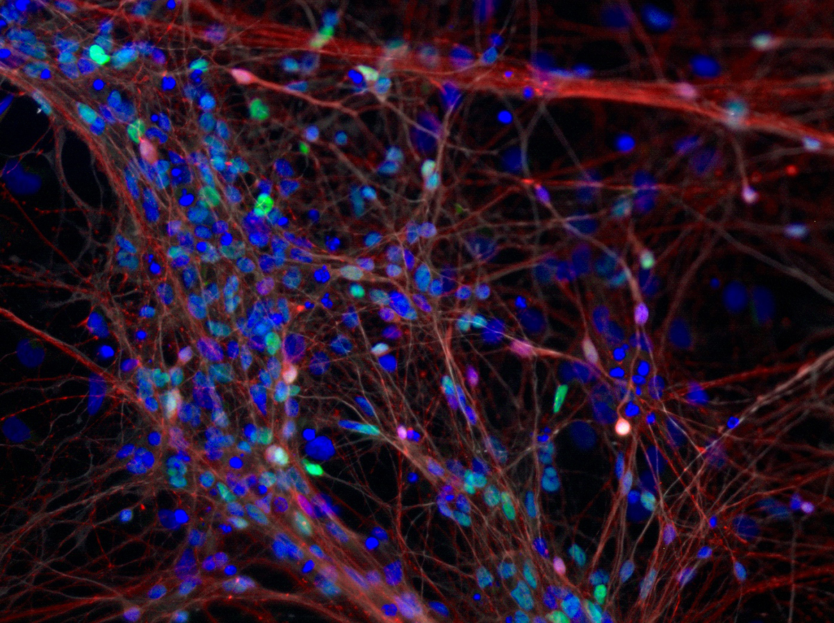 Microscopic view of a neuron Emma created as part of her research focused on Huntington's disease.