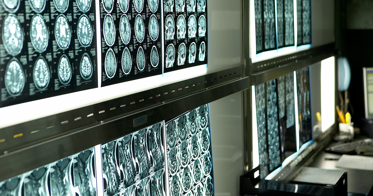 Neurology scans of the brain