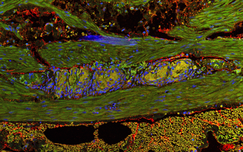 Microorganisms that live in our intestines including M. Smithii