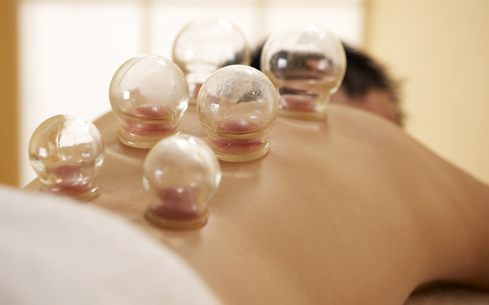 cupping, alternative medicine, health benefts, deep-tissue massage