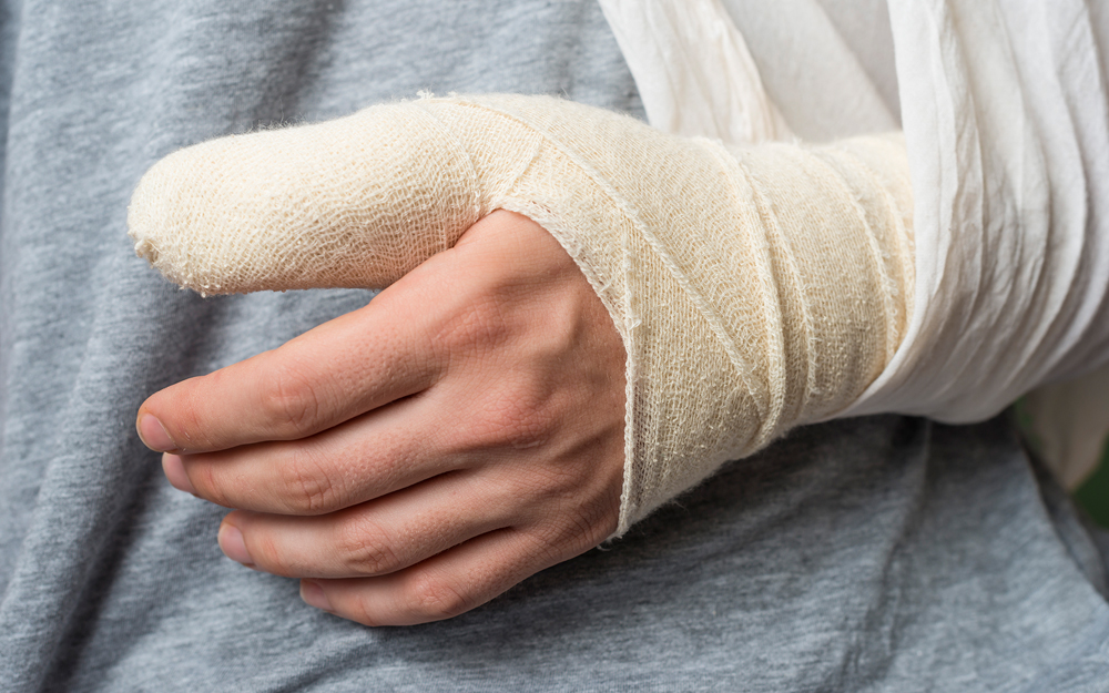 Athletes Can Return to Play in Half the Time with New Thumb Ligament Surgery