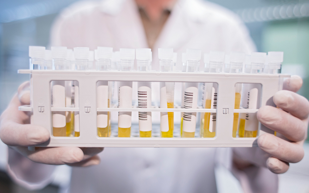 COVID-19, testing, blood, convalescent plasma, Cedars-Sinai