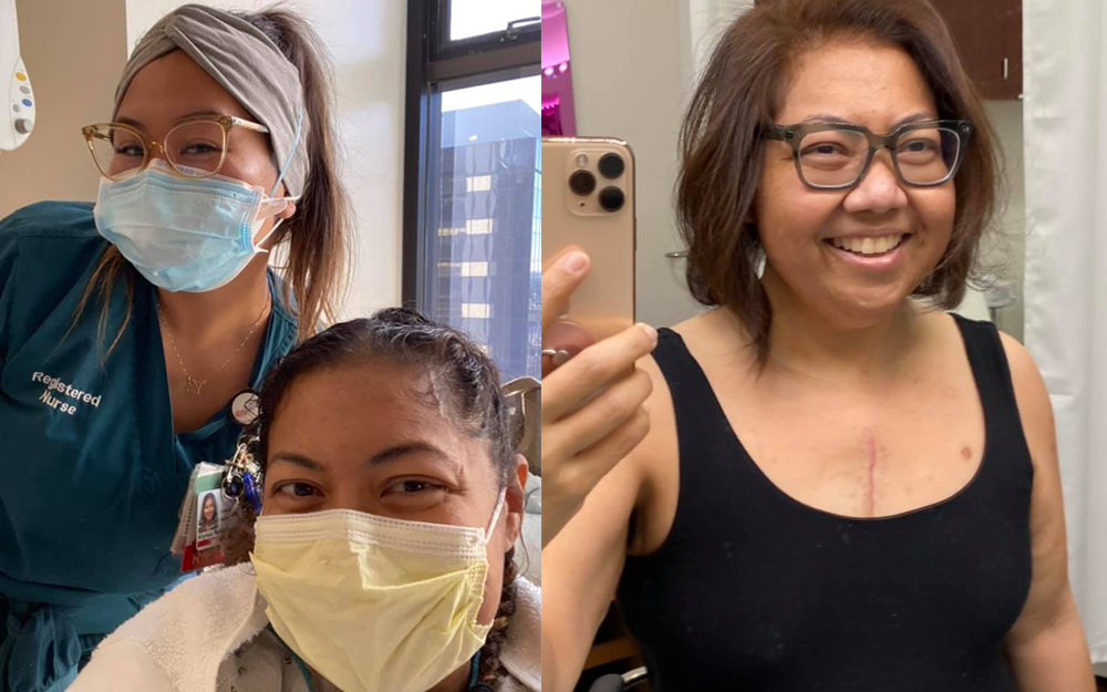 Heart Transplant Los Angeles, CA CedarsSinai