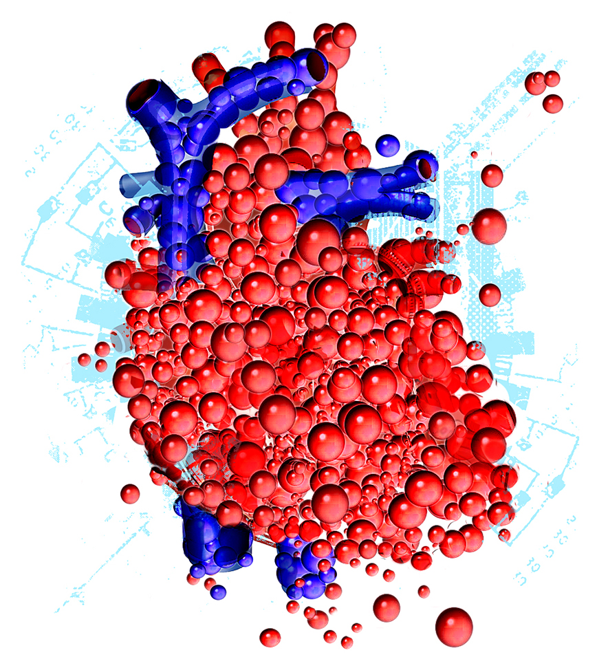 An illustration depicting advances of coronary revascularization at Cedars-Sinai.