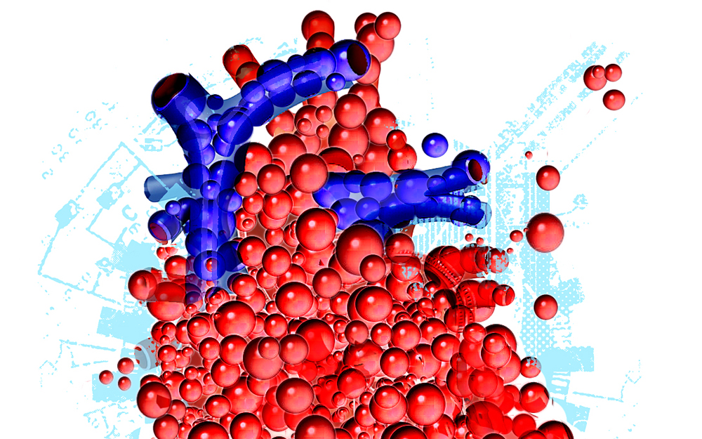 Advanced Coronary Revascularization for Severe Coronary Disease