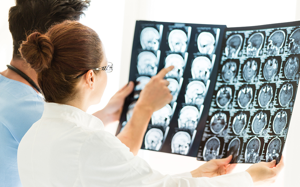 Two doctors looking at MRI scan image of the brain.