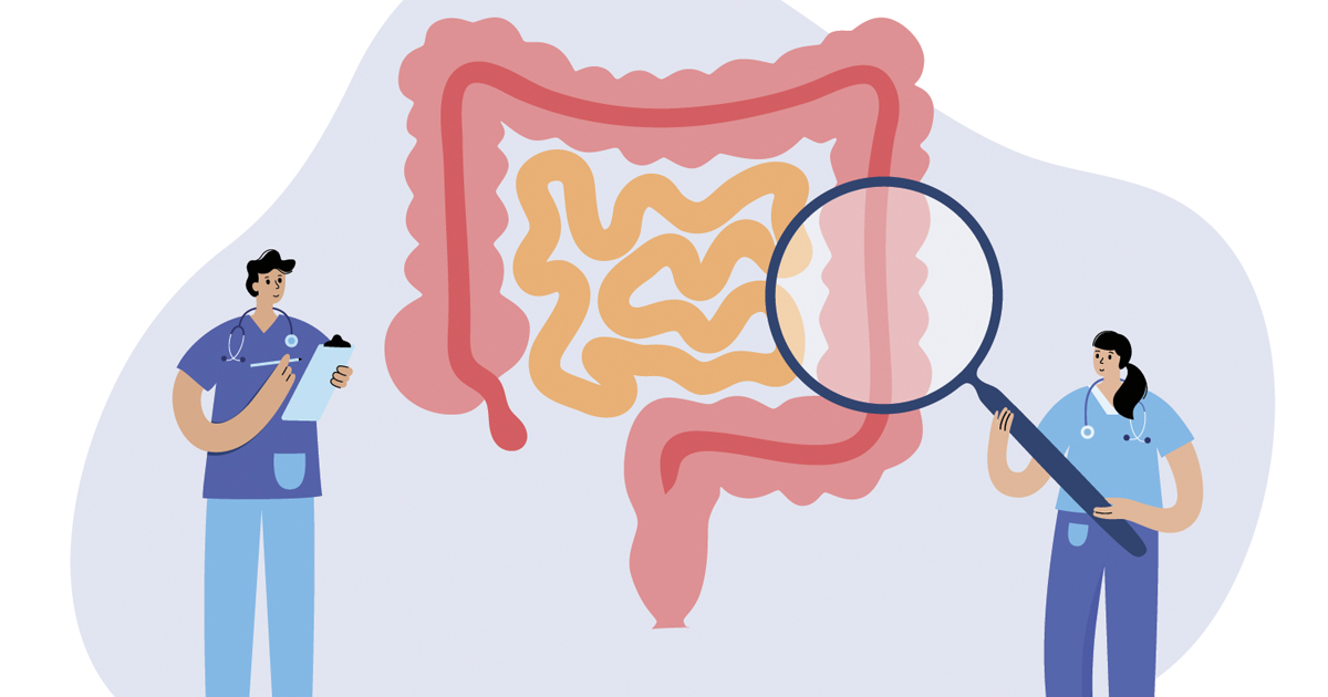 At-Home Colorectal Cancer Screening: What You Should Know ...