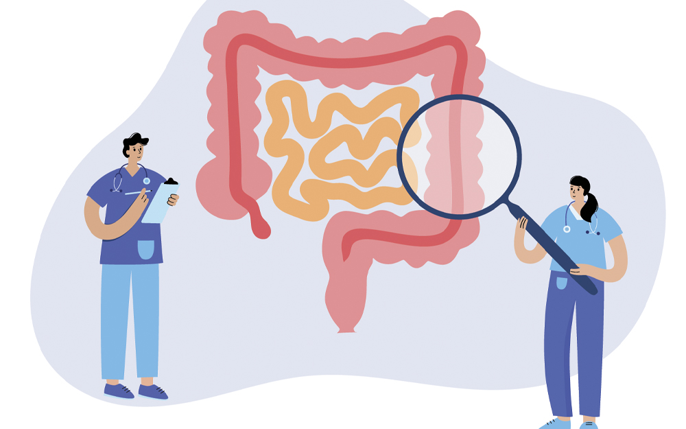 What people should know about at-home colorectal cancer screening test kits