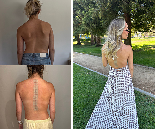 Milan Brahney wearing an open-back dress.