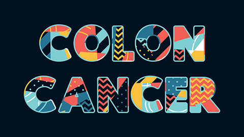 Colon Cancer