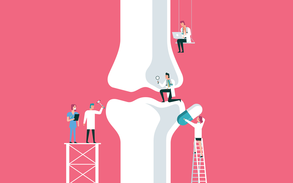 An illustration of advances in hip and knee replacement surgery.
