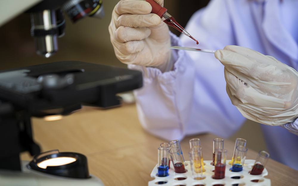 Scientist dropping blood samples on slide microscope using a pipette.