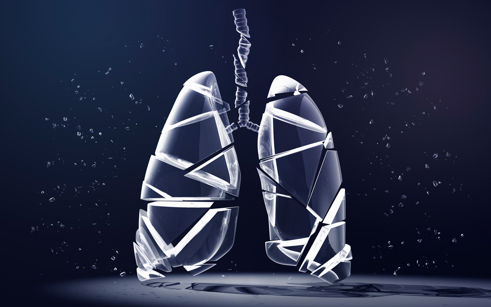 Respiratory Therapists Glean New Knowledge from Treating COVID-19 Patients teaser image