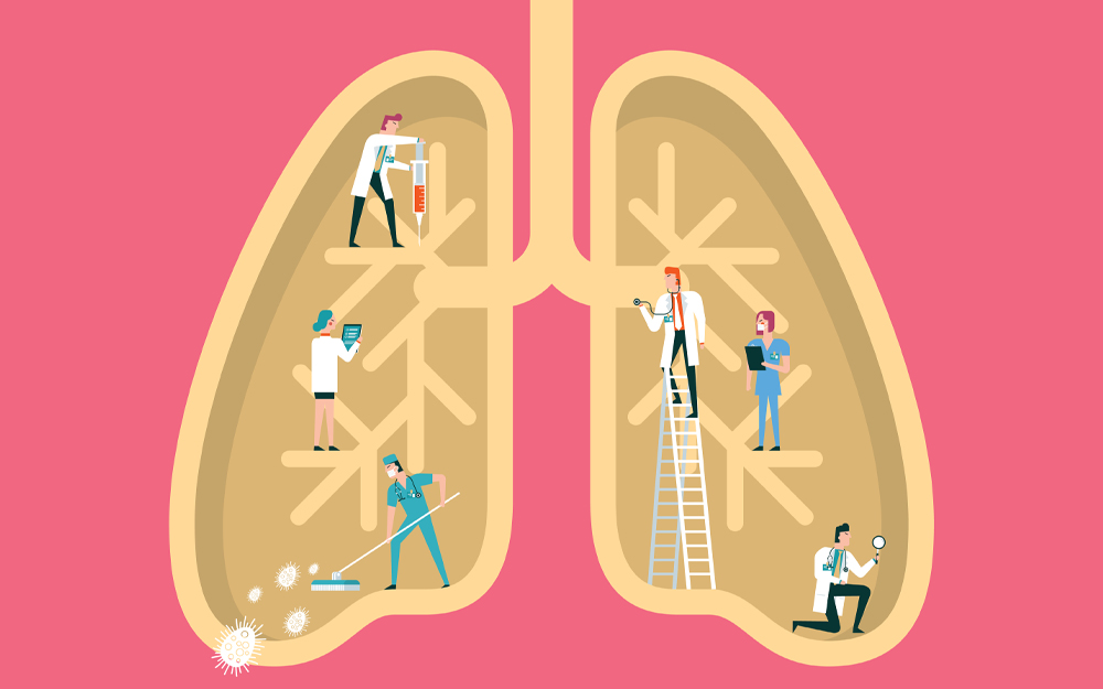 Team of doctors diagnosing a pair of lungs