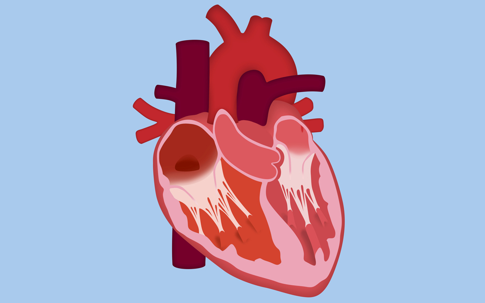 An illustration of a heart.