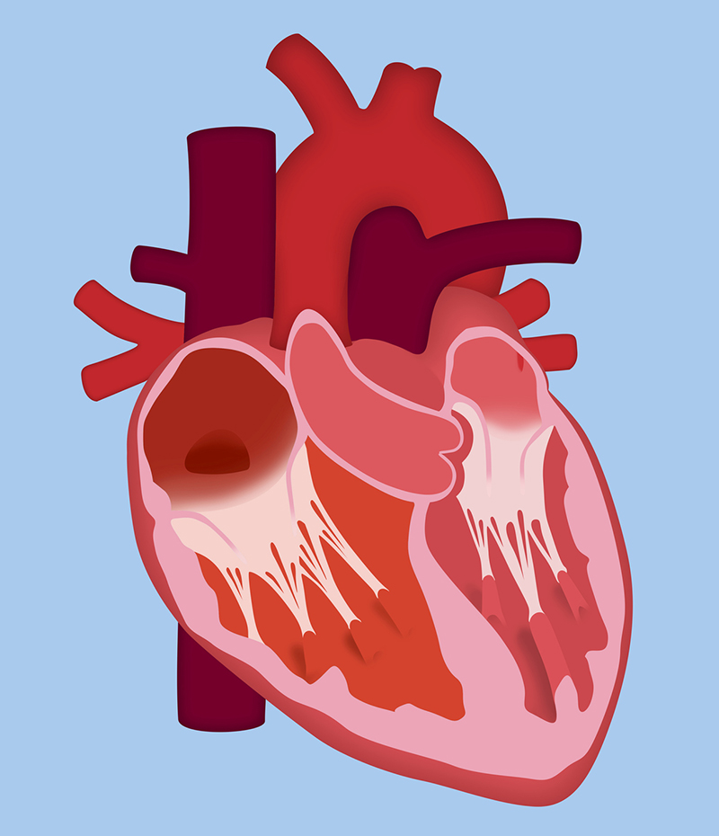 An illustration of a heart.