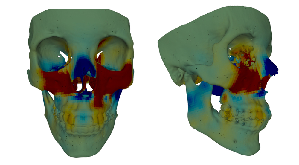 Facial heat map