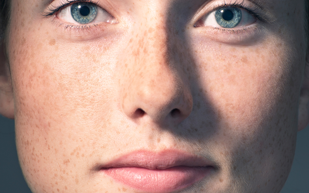 An Objective Approach to Facial Feminization Surgery