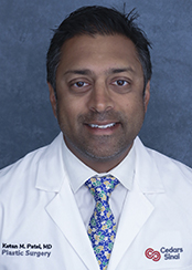 Ketan M. Patel, MD