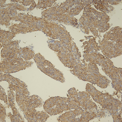 SMA IHC, 20x