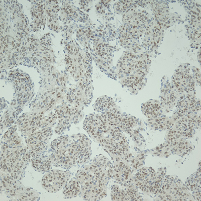 SMA IHC, 20x