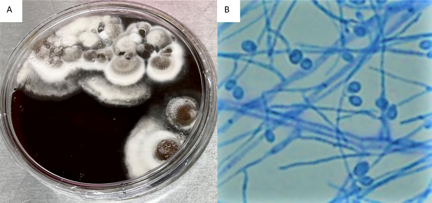 Figure 2. Brain Heart Infusion (BHI) Agar plate growing Scedosporium apiospermum (A), Scedosporium apiospermum septate hyphae & conidia (B)