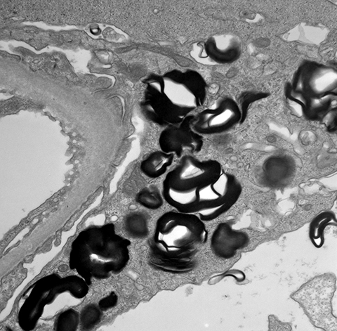 Renal Pathology tissue