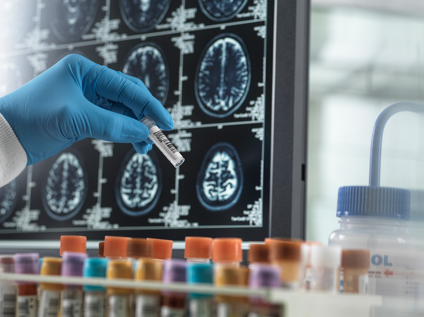Memory Test Inpatient Memory Disorders – Los Angeles, California | Cedars-Sinai Health ...