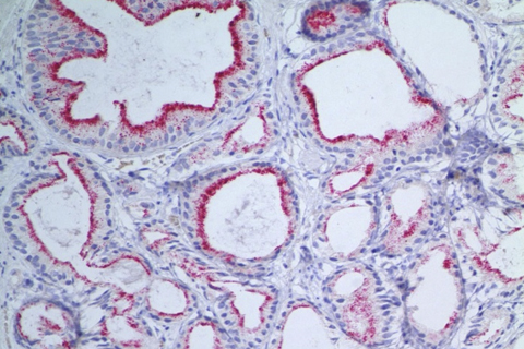 genitourinary pathology sample