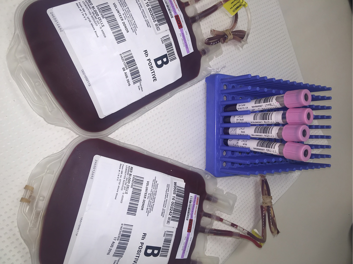 Two blood bags with 4 viles of blood.