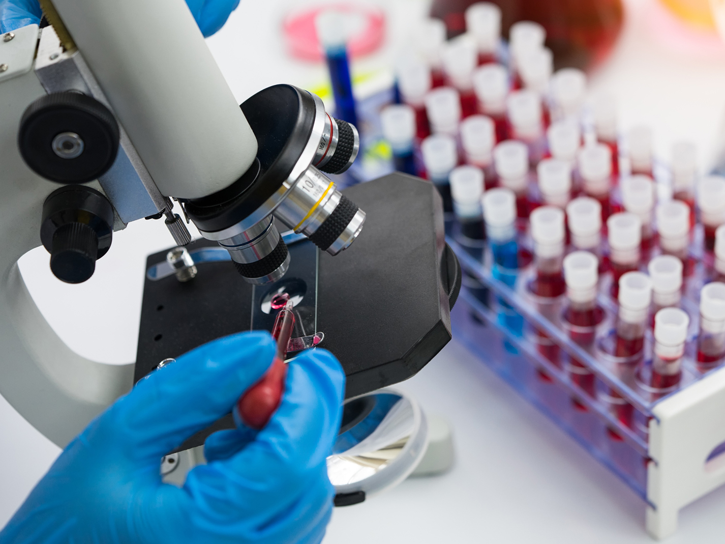Microscope and vials