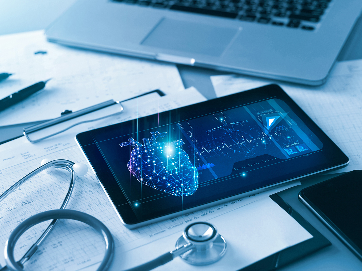 Heart Transplant Los Angeles, CA CedarsSinai