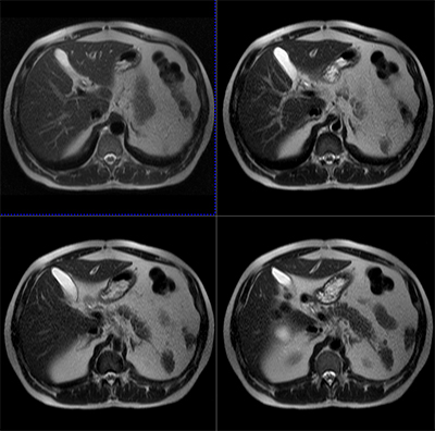 Magnetic Resonance Imaging - with |