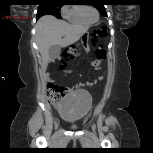 of the Abdomen/Pelvis | Cedars-Sinai