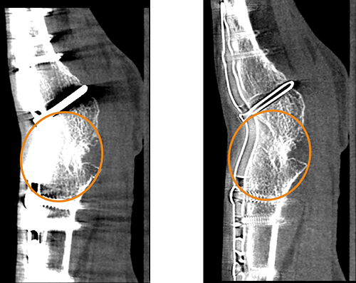 https://www.cedars-sinai.org/content/dam/cedars-sinai/programs-and-services/imaging-center/for-patients/exams-by-procedure/extremity-ct-wrist.jpg