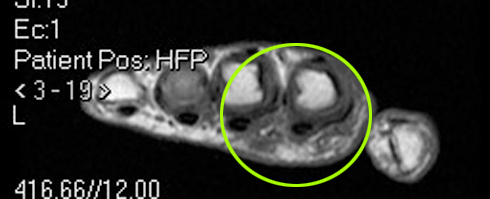 What are the best scans for imaging the body?