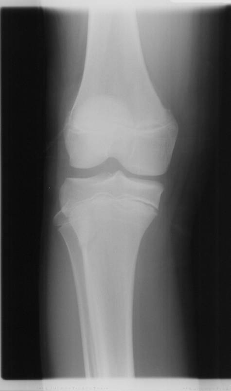 Home Lower Extremity Review Magazine