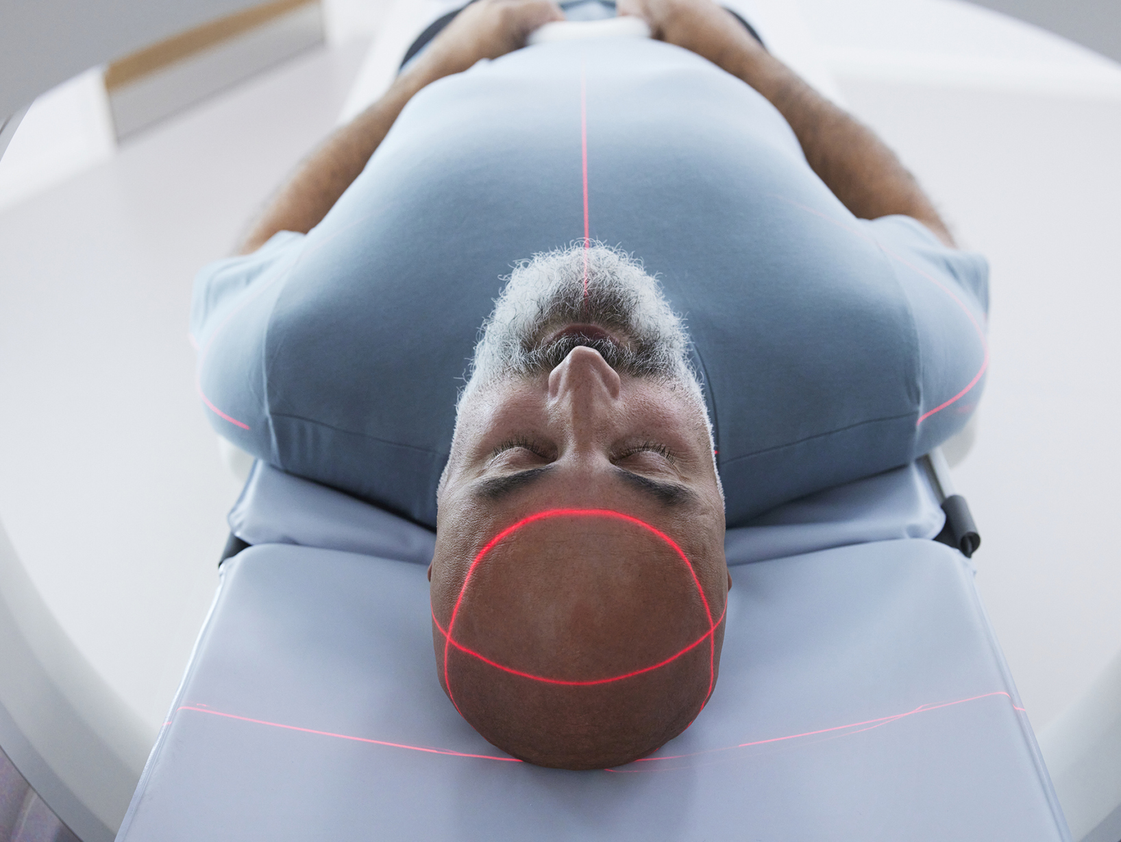 Neurology & Neurosurgery Los Angeles, California CedarsSinai