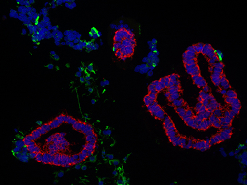 Image of human intestinal organoid or HIO derived from iPSCs (stem cells.)